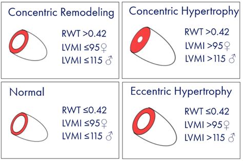 lv rwt|lv mass index normal range.